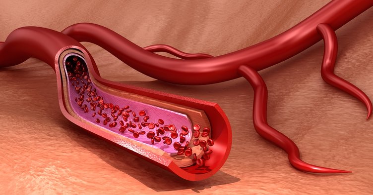 Kaçış Sendromu hastalığı nedir? Belirtileri ve tedavisi